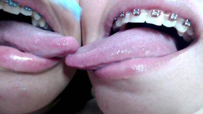 Deep tounge kissing between two brace lesbian - hclips